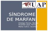 Síndrome de-marfan-1