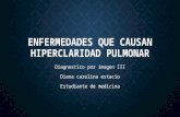 Alteraciones parenquimatosas (HIPERCLARIDAD PULMONAR)
