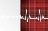 Electrocardiograma ( HIPERTROFIA )