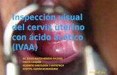 INSPECCION VISUAL CON ACIDO ACETICO IVAA
