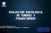 Evaluación Radiológica de tumores oseos
