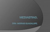 Mediastino - 03 -16
