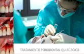 Tratamientos periodontales quirúrgicos.