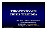 TIROTOXICOSIS CRISIS TIROIDEA