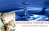 Hidrocefalia pediatrica gavilanes aguilar