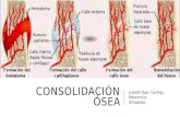 2.1 consolidación ósea