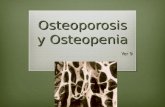 Osteoporosis y osteopenia