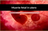 Muerte fetal in utero