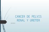 Cancer de pelvis renal y ureter
