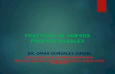FRACTURA DE HUESOS NASALES - DR. OMAR GONZALES SUAZO.