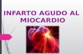 Infarto Agudo al Miocardio.