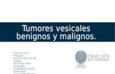Tumores vesicales
