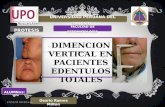 Dimencion vertical en pacientes edentulos totales