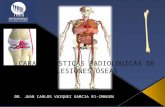 Caracteristicas Radiologicas de las Lesiones Oseas