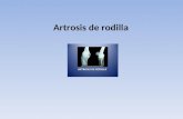 Artrosis rodilla 1