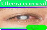 Úlceras corneales