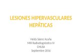 Lesiones hipervasculares hepáticas