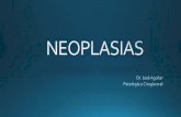 5 neoplasia
