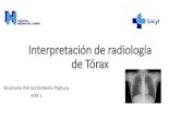 Sesion radiologia de torax help