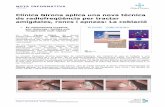 Clínica Girona aplica una nova tècnica de radiofreqüència ... · PDF file(Electrocirurgia bipolar) AMÍGDALES ... hipertròfiques, la qual cosa provoca dificultat respiratòria