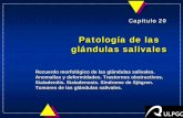 Patología de las glándulas salivales - · PDF fileuDeterminación del flujo salival uANALÍTICA: Factor reumatoide, hipergammaglo-bulinemia, < seroalbúmina uA veces anemia persistente,