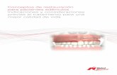 Conceptos de restauración para pacientes edéntulos ...galiciadental.com/web2017/wp-content/uploads/2016/06/73178-A... · de dentición/dentición terminal para establecer un resultado