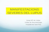 MANIFESTACIONS SEVERES DEL LUPUS - academia.cat · Tratamiento de mantenimiento ... Sepsis por listeria con hemo, ... Biopsia renal de control: GN II y V con indice actividad de 2
