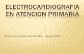 Electrocardiografia en atencion primaria - INICIO · No requiere derivación, solo control anula de EKG ... En mayores de 80 años se observa en 6-11% en EKG y 76% Holter Solo revisten