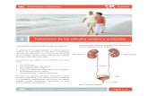 03 Tratamiento de los c lculos renales y ureterales · Información a pacientes - Tratamiento de los cálculos renales y ureterales Página 1 / 11 ... analgésicos más fuertes llamados
