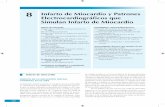 8 Infarto de Miocardio y Patrones Electrocardiográficos que Simulan Infarto de Miocardiomedia.axon.es/pdf/81691_3.pdf · Aumento de la amplitud de R Tratamiento trombolítico y angioplastia