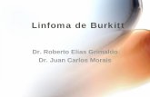 Linfoma de Burkitt - Expertos en Alergología e … · testicular, de predominio izquierdo. Examen Físico ... peritoneales en relación al hilio hepático y la cabeza del páncreas.