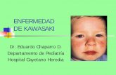 ENFERMEDAD DE KAWASAKI - intramed.net · Enfermedad de Kawasaki Es la segunda causa de enfermedad vasculítica en la niñez. Está asociada con el desarrollo de vasculitis sistémica