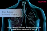 CASO CLÍNICO PATOLOGÍA TORÁCICA - seap.es · En países endémicos para tuberculosis los resultados del PET-TAC deben ser interpretados con precaución . 54 pacientes con diagnóstico