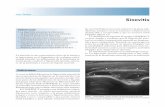 Sinovitis - EULAR Ultrasound Reuma · vial es un tejido intraarticular anormal no desplaza - ... trado que es superior a la evaluación clínica de la ... determinar la naturaleza