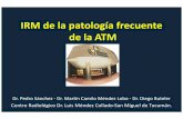IRM de la patología frecuente de la ATM - IMAGENES …congreso.faardit.org.ar/uploads/2015/poster/2015_735_PE... · IRM de la patología frecuente de la ATM Dr. Pedro Sánchez -Dr.