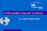 Enfermedad Vascular Cerebral - ramospeek.comramospeek.com/docs/EVC08.pdf · Historia familiar de ECV Diabetes Estilo de vida Fibrilación auricular Homocisteinemia Hiperlipidemia