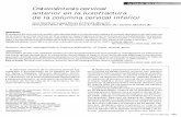 Artículo de revisión Osteosíntesis cervical anterior en la ...revmexneuroci.com/wp-content/uploads/2014/07/Nm0045-14.pdf · portes de placas y tornillos confeccionados con fusilian,