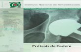 Prótesis de Cadera - inr.gob.mx · nes postquirúrgicas, sobre los cuidados de la herida, uso de medicamentos para control de dolor, inﬂ amación, an- titromboticos, cuidados personales