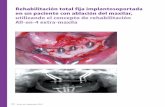CC Malo.QXP 26/8/10 13:37 Página 84 Rehabilitación … · 2012-07-19 · maxila, pretenden la rehabilitación fija sobre implantes con estética y función inmediatas, presentando