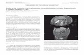Perforación vesicular tras traumatismo …scielo.isciii.es/pdf/diges/v109n4/es_imagen1.pdf2017, Vol. 109, N.º 4 PERFORACIÓN VESICULAR TRAS TRAUMATISMO TORACOABDOMINAL CERRADO DIAGNOSTICADO