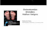 Osteotomias Distales Hallux Valgus - Cirugía del pie y ... · Roberto de los Mozos Unidad de Pie y Tobillo Cirugía Ortopédica y Traumatología. H.Universitario de Alava VIII CURSO