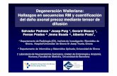 Degeneración Walleriana: Hallazgos en secuencias RM …seram2010.seram.es/modules/posters/files/microsoft_powerpoint... · debido a la rotura de los lípidos mielínicos, proliferación