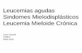 Leucemias agudas Sindomes Mielodisplásticos … · LA’s. Definición y epidemiologìa: • Proliferación clonal de células hemato/linfopoyèticas inmaduras y “anormales”