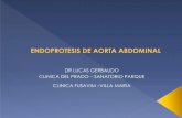Aneurismas de aorta abdominal - caci.org.arcaci.org.ar/assets/misc/docs/charlas/8-lucas-gerbaudo.pdf · ( RECORDAR PALPAR EL ABDOMEN ¡¡¡¡ ) ... como mínimo • Las arterias ...