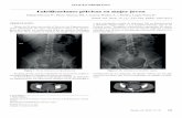 Calcificaciones pélvicas en mujer joven - scielo.isciii.esscielo.isciii.es/pdf/sm/v72n3/imagen_problema.pdf · y una radiografía simple de abdomen AP, en bipedestación y decúbito