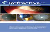 Impacto de la super˜cie ocular en la cirugía premium | …sacryc.com.ar/revistas/2017/Refractiva_47.pdf · blefaritis y glándulas de Meibomio (figura 2): junto con la del menisco
