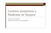 Lesiones purpúricasy Síndrome de Sjogren - fesemi.org · lesiones en relación con una BONO. Múltiples consolidaciones parenquimatosas alveolares inespecíficas sin evidencia de