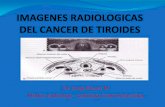Dr. Jorge Ferrey M Medico radiólogo –radiólogo ... · Quiste tirogloso Quiste branquial, de retención ...