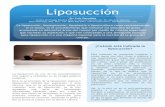 Liposucción - República Dominicanaciruplastic.com/pdf/liposuccion.pdf · Siempre en el ambiente controlado de la sala de cirugía, con el monitoreo cardio-respiratorio de rigor