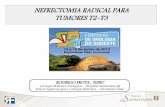 NEFRECTOMIA RADICAL PARA TUMORES T2-T3rvmaiseventos.com.br/encontrosudeste/aulas/dia 14/11h00 - RODRIGO... · NEFRECTOMIA RADICAL PARA TUMORES T2-T3 . NEFRECTOMIA PARCIALTNM . NEFRECTOMIA
